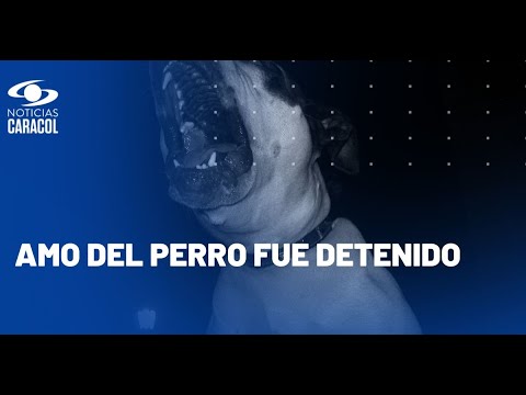 Niño atacado por perro pitbull en Bogotá recibió 35 puntos de sutura