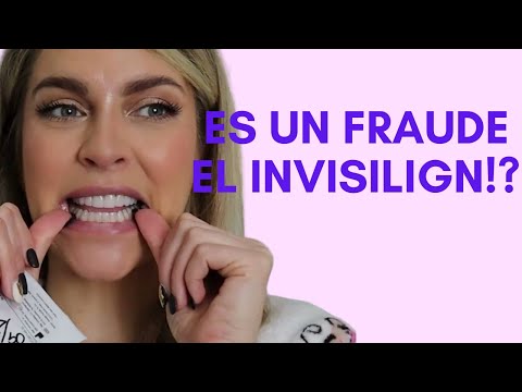 FUNCIONAN LOS INVISILIGN!- Dany Di Giacomo