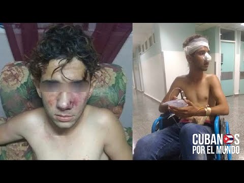 Menor de edad en Cuba recibe fuerte golpiza y su agresor quedó en libertad