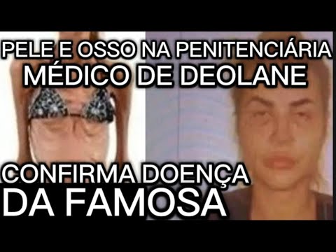 URGENTE DA PENITENCIÁRIA MÉDICO INFELIZMENTE CONFIRMA SITUAÇÃO CRÍTICA DE DEOLANE ESTÁ PELE E OSSO