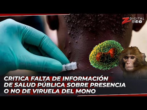 Iluminada critica falta de información de Salud Pública sobre presencia o no de viruela del mono