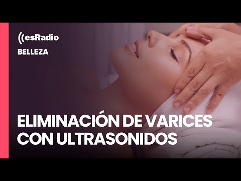 Belleza: Eliminación de varices con ultrasonidos, sin cirugía