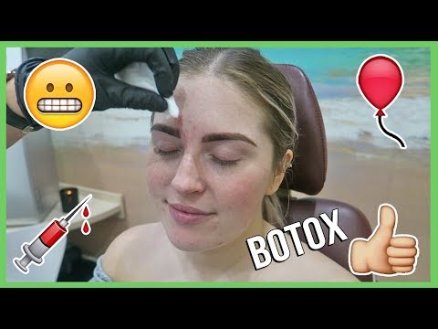 BOTOX AND XOBEAUTY ? Vlog 613