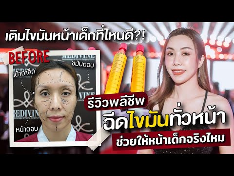 รีวิวพลีชีพฉีดไขมันหน้าเด็กทั