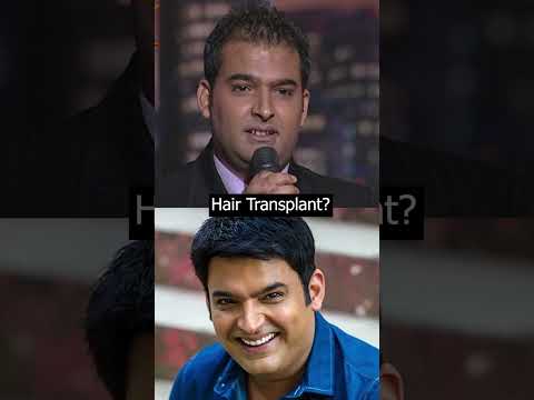 Did Kapil Sharma Get a Smile Makeover?