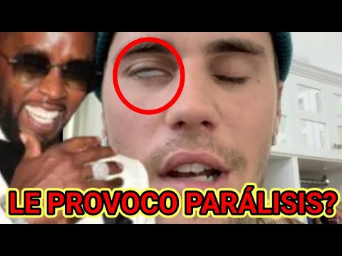 JUSTIN BIEBER ABANDONÓ LA MÚSICA POR TERRIBLE SÍNDROME, POR CULPA DE PUFF DADDY - SEAN DIDDY COMBS