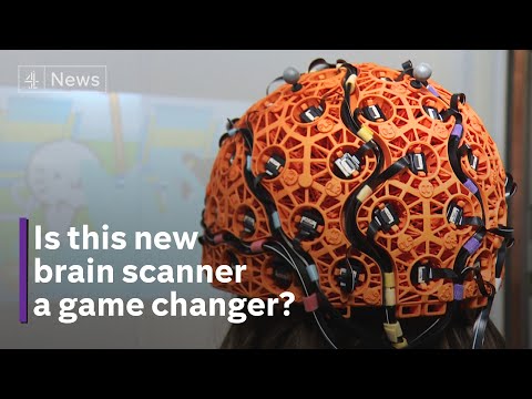 New brain scanner could revolutionise treatment of children with epilepsy