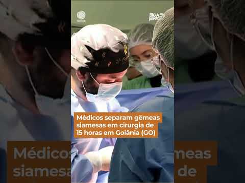 Médicos separam gêmeas siamesas em cirurgia de 15 horas em Goiânia (GO) #Shorts #FalaBrasil