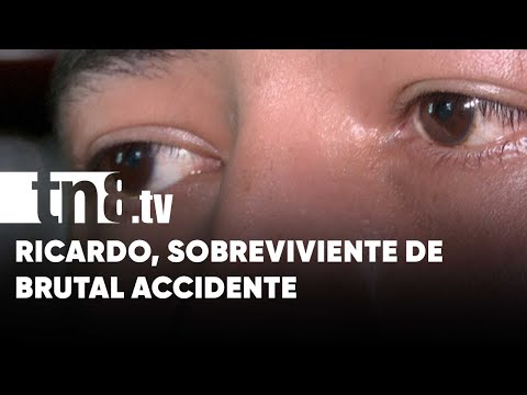 ¡Sobreviví!: La historia de Ricardo, quien sufrió atroz accidente en Managua - Nicaragua