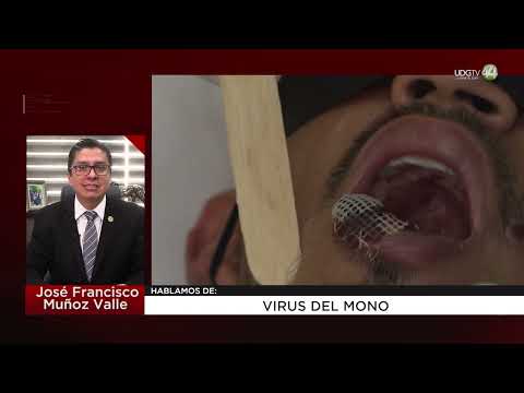 Virus del mono: José Francisco Muñoz Valle