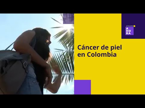 Colombia es el país número 15 con casos de cáncer de piel