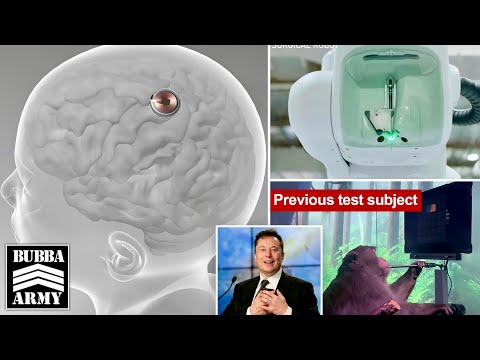 Elon Musk's Neuralink Implants First Chip in Human - Bubba the Love Sponge® Show | 1/30/24