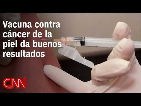 Avanza exitosamente estudio de vacuna contra cáncer de la piel