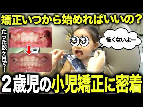 【何歳からが正解?】2歳から始める小児矯正の初回診療に密着してみた!