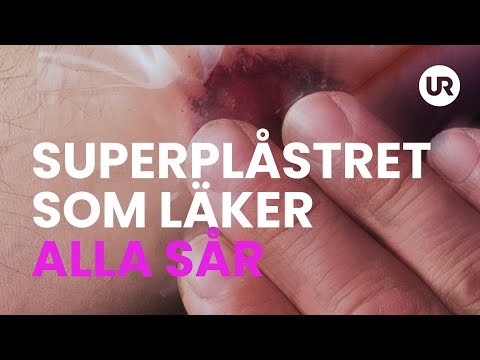 Sverige forskar: Superplåstret som läker alla sår