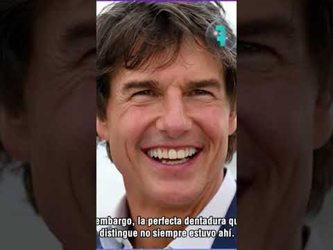 La belleza de Tom Cruise podría ser resultado de varios arreglitos estéticos