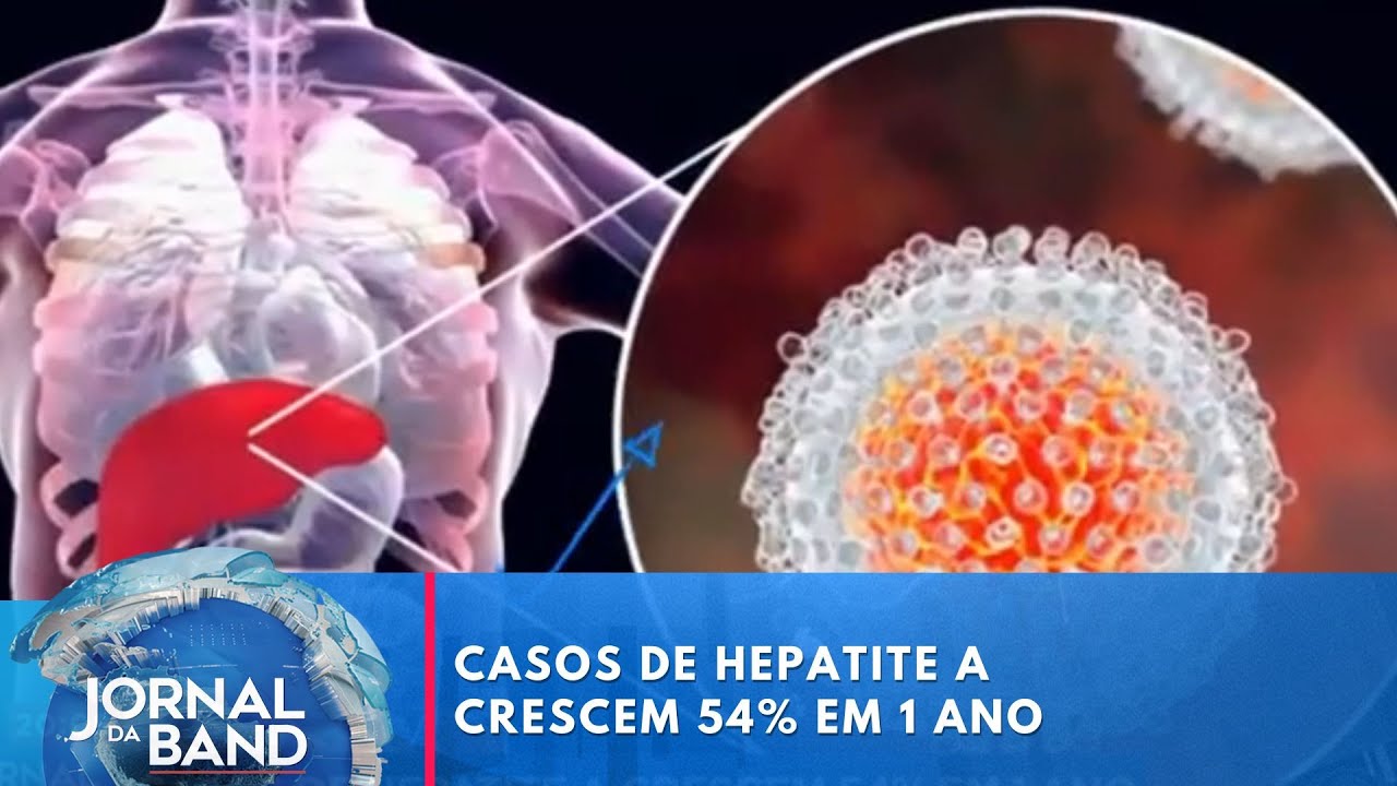 Casos de hepatite A crescem 54 em 1 ano | Jornal da Band