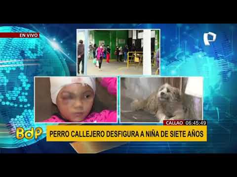 Madre denuncia negligencia tras operación de su niña que fue desfigurada por un perro