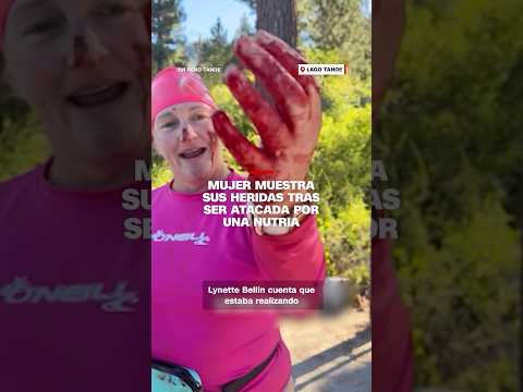 Mujer muestra las secuelas sangrientas de un ataque de nutria en el lago Tahoe