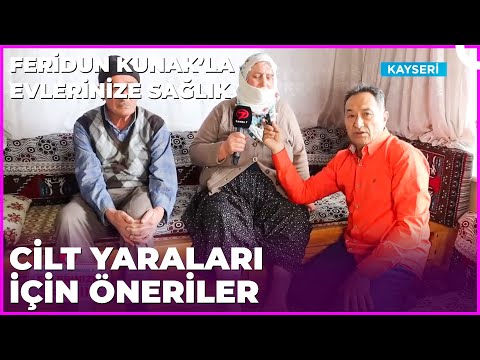 Cilt Yaraları İçin Öneriler | Dr. Feridun Kunak’la Evlerinize Sağlık