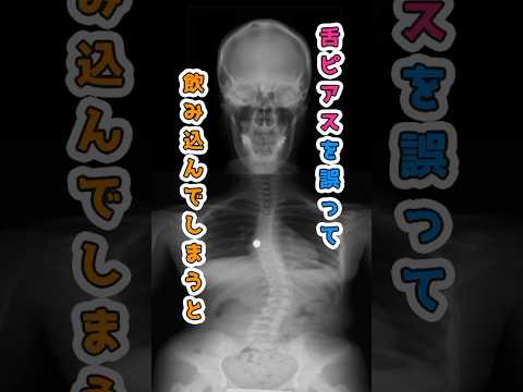 舌ピアスの誤飲経験と安全に楽しむためのポイント サムネイル