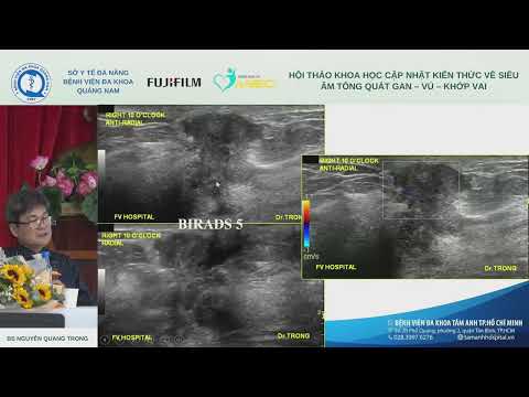 [S] Phân loại siêu âm ACR BIRADS tuyến vú (BS Nguyễn Quang Trọng)