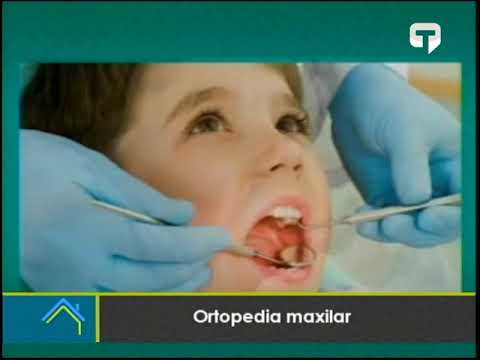 Ortopedia maxilar