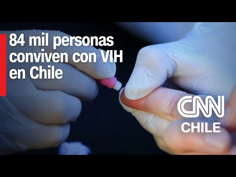 Día Mundial de la Lucha contra el Sida y el VIH: ¿Cuál es la situación en Chile?