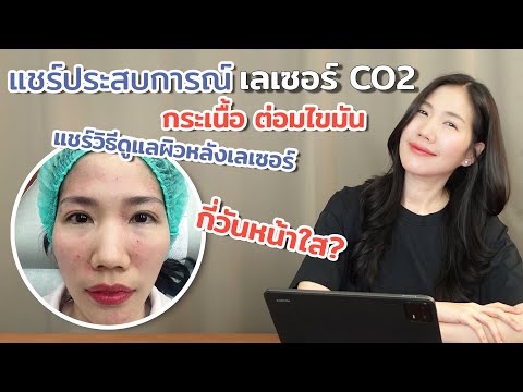 รีวิวเลเซอร์co2กระเนื้อต่อมไ