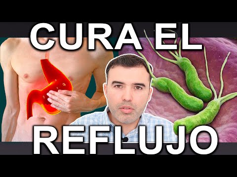 CURA TU REFLUJO 100% EFECTIVO Como Revertir El Reflujo Gastrico Y Eliminar La Gastritis Naturalmente