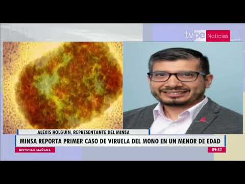 Noticias Mañana | Alexis Holguín, representante del Minsa - 30/08/2022