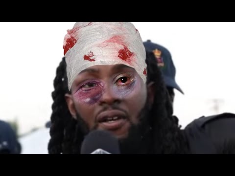 honormosity arrested by police fully bad mash up his eyes* it swell sting 2023*!watch full interview