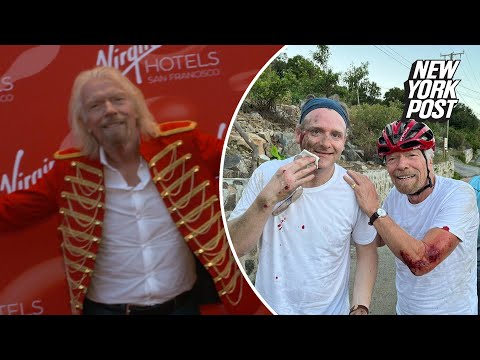 Gruesome photos show Richard Branson’s nasty injuries after falling from bike
