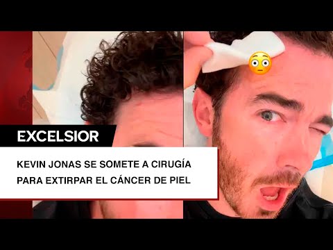 ‘Recuerden revisar los lunares’, Kevin Jonas se somete a una cirugía para extirpar el cáncer de piel