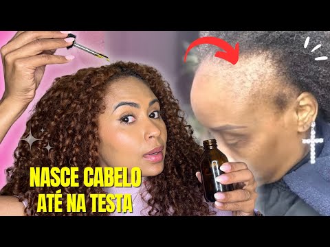 Thumbnail Video Youtube