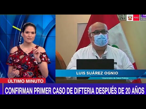 Confirman caso de difteria en Lima en niña de 5 años