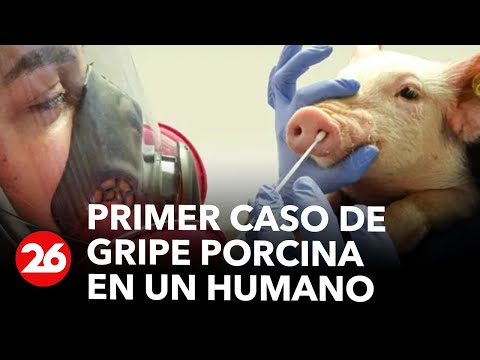 Confirman primer caso de gripe porcina en un ser humano