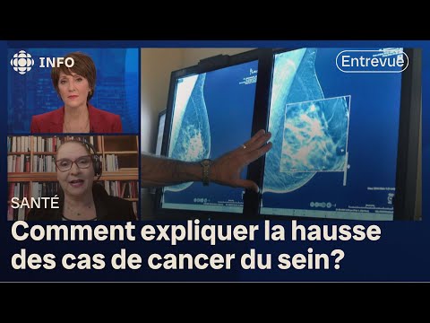 Hausse alarmante des cas de cancer du sein : entrevue avec la Dre Dominique Synnott