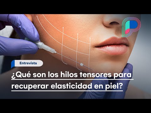 ¿Qué son los hilos tensores para recuperar elasticidad en piel?: Dr. Carlos López Carrillo explica