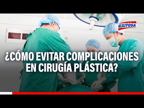 'Muñequita Milly': ¿Cómo evitar complicaciones en cirugía plástica? Cirujano plástico responde