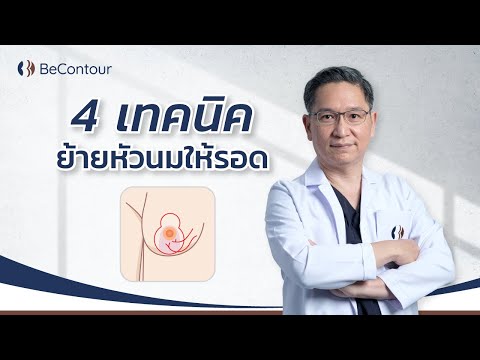 4เทคนิคย้ายหัวนมให้รอดเรื่อ