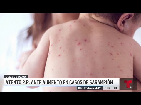 Atentos en Puerto Rico a brotes de sarampión en Estados Unidos