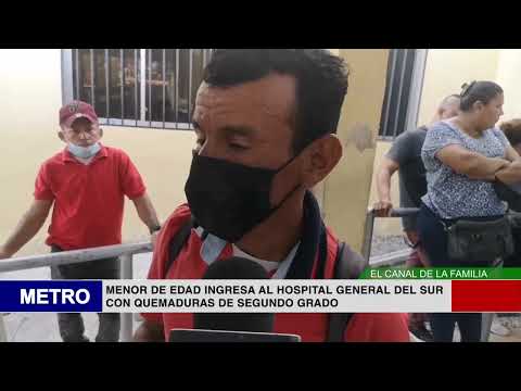 2  MENOR DE EDAD INGRESA AL HOSPITAL GENERAL DEL SUR CON QUEMADURAS DE SEGUNDO GRADO
