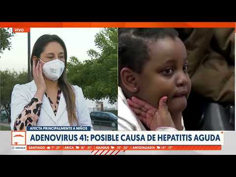 Adenovirus 41 sería responsable de hepatitis aguda infantil
