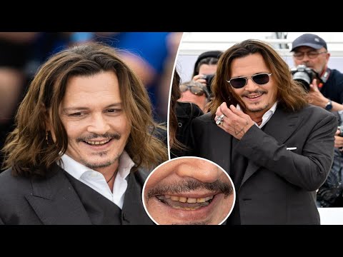 Johnny Depp impacta en Cannes por el mal estado de sus dientes