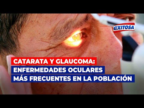 Catarata y glaucoma: enfermedades oculares más frecuentes en la población