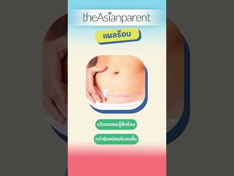 รวมอาการผิดปกติหลังผ่าคลอดth