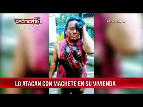 Hombre resulta macheteado en su propia vivienda en Ometepe - Nicaragua