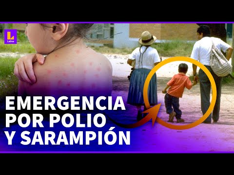 POLIO Y SARAMPIÓN EN PERÚ: Todo lo que debes saber sobre estas enfermedades