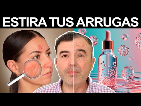 REJUVENECE 10 AÑOS CON ACIDO HIALURONICO - Para Que Sirve, Belleza, Arrugas Y Mas